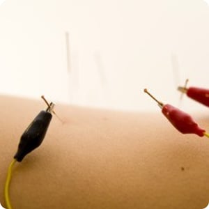 Sinomedica_ Electroacupuncture