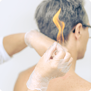 Sinomedica_Fire_Needle_Therapy-second