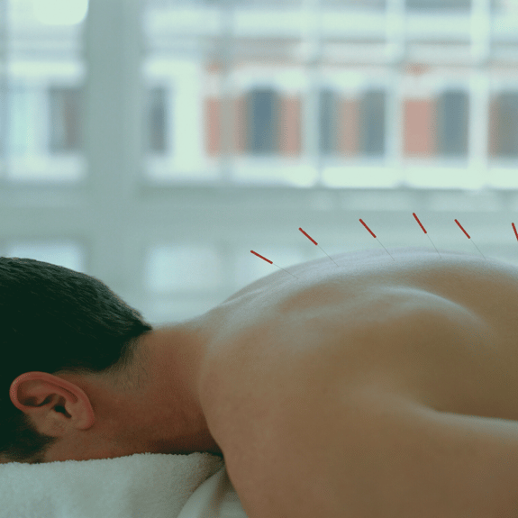 acupuncture-is-an-effective-treatment-for-post-stroke-spasticity
