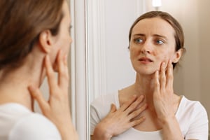 Akne, Ekzeme und Dermatitis: Die Rolle der Akupunktur für die Haut